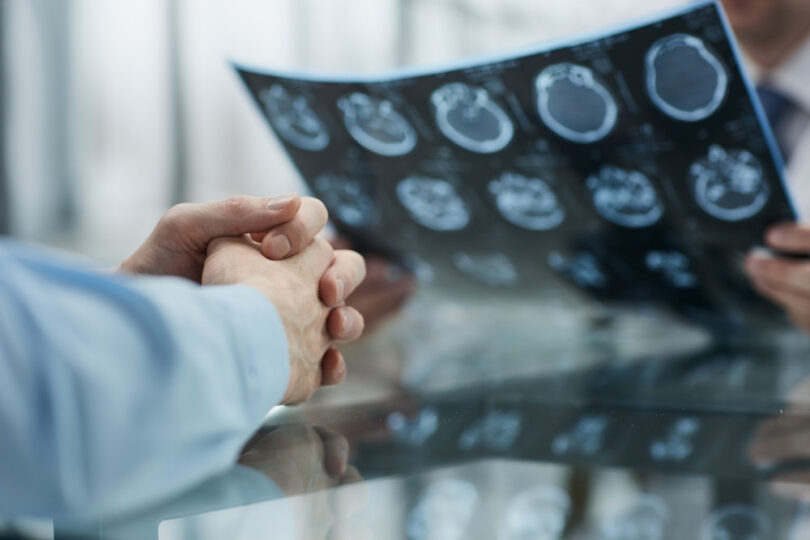 doctor showing a brain ct scan to a patient during a consultation