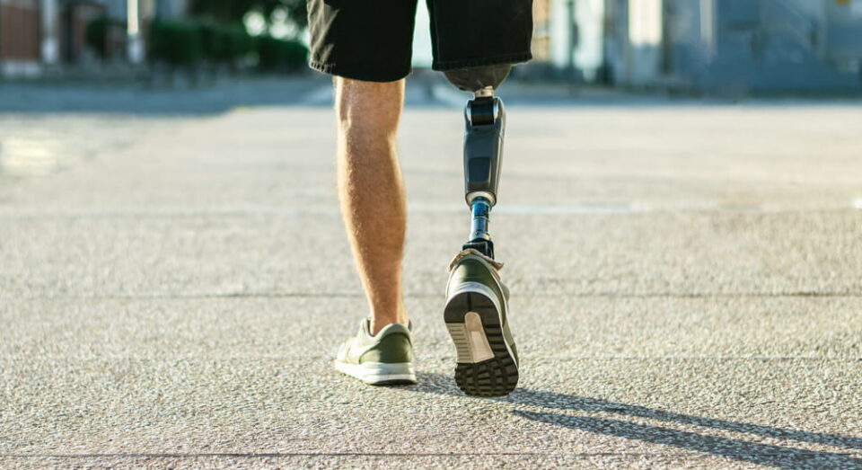 Person Walking With Prosthetic Leg
